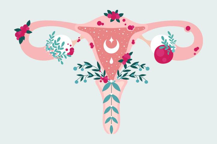 Fertilização in vitro e endometriose