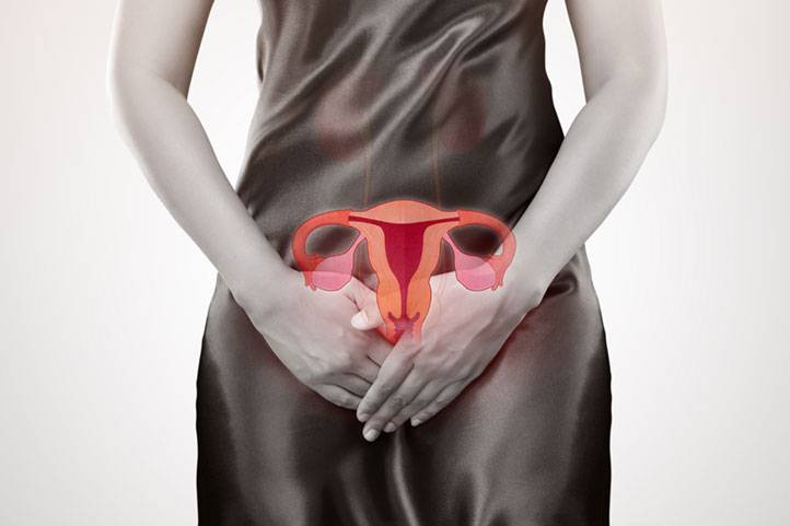 Endometriose e Infertilidade